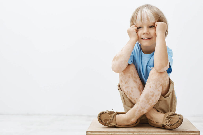 Choroby skóry u dzieci — kiedy rodzic powinien udać się z dzieckiem do dermatologa?
